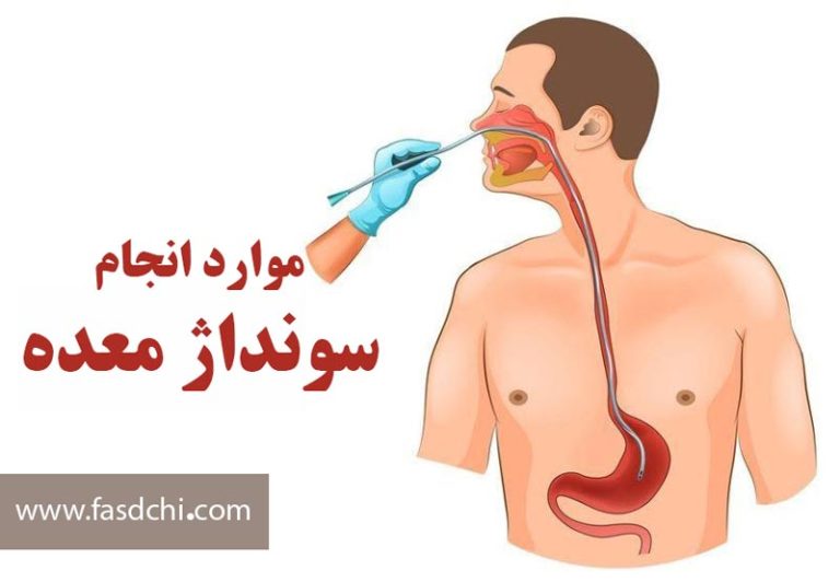 موارد انجام سونداژ معده